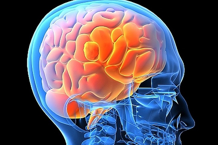 a medical looking picture of a man's head with his brain highlighted in red